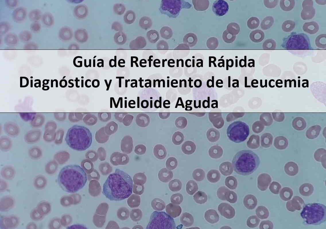 Guía de Referencia Rápida: Diagnóstico y Tratamiento de la Leucemia Mieloide Aguda