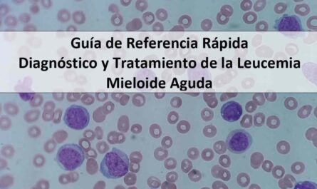 Guía de Referencia Rápida: Diagnóstico y Tratamiento de la Leucemia Mieloide Aguda