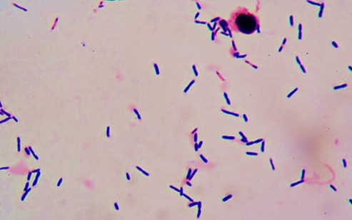 Manual de Microbiología Clínica - Bacterias de Importancia Clínica, bacilos gram positivos