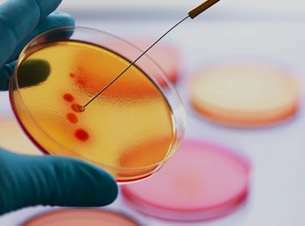 MANUAL DE LABORATORIO DE MICROBIOLOGÍA - Sembrando en placa petri