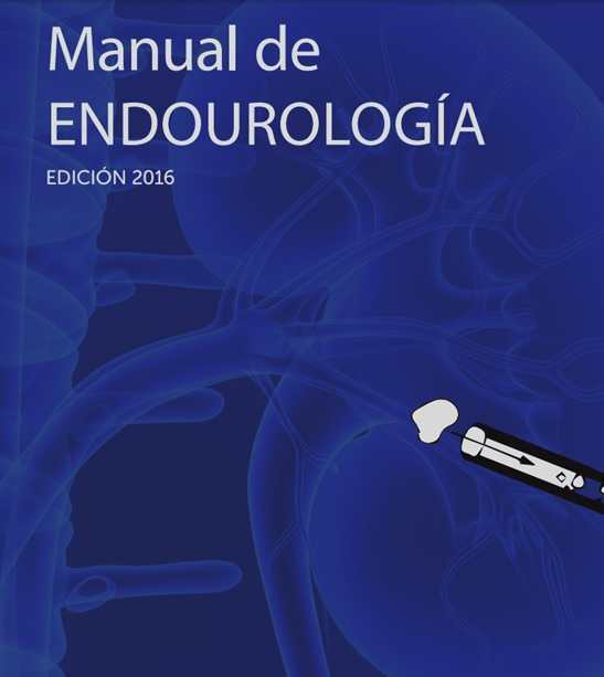 Manual de endourología